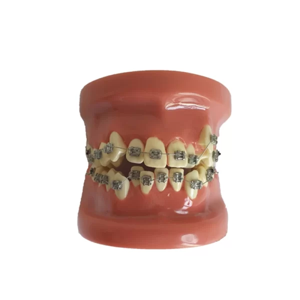 Model dentar orthodontic B4-01