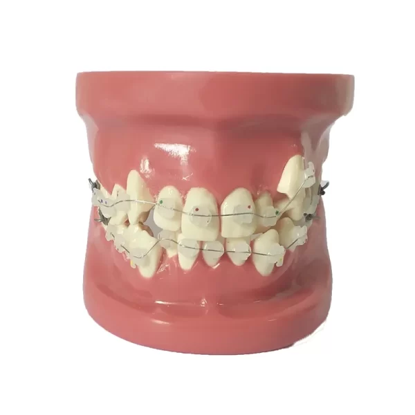 Model dentar orthodontic B4-03