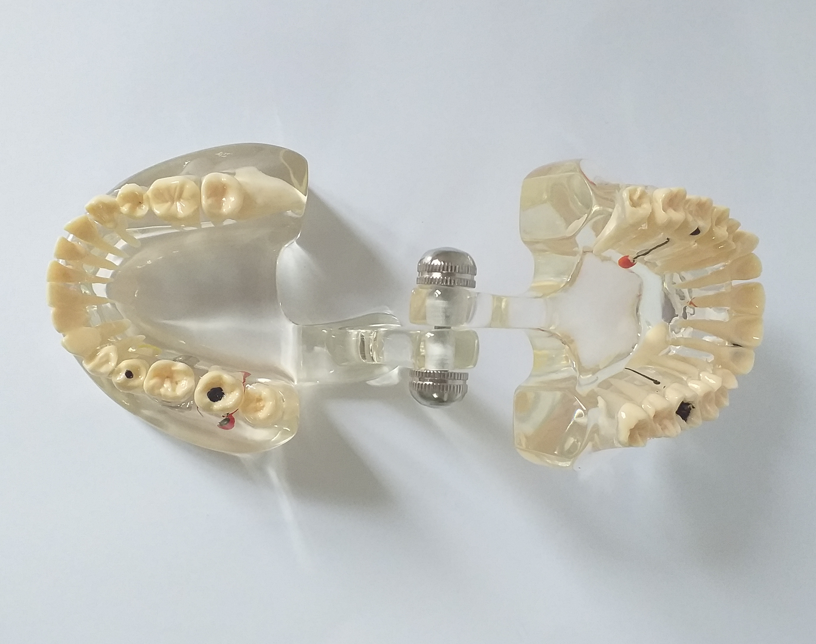 Model dentar patologic C4